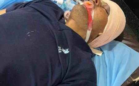 वाराणसी: मिर्जामुराद में युवक ने खुद को मारी गोली, हालत गंभीर