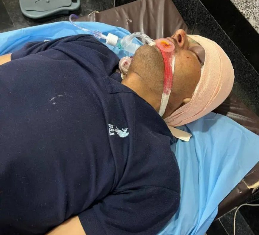 वाराणसी: मिर्जामुराद में युवक ने खुद को मारी गोली, हालत गंभीर