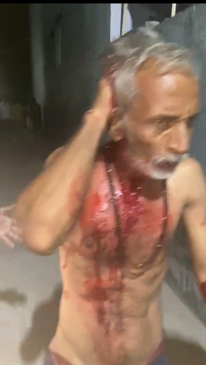 गिट्टी गिराने के विवाद में मनबढ़ पट्टीदारों ने बुजुर्ग को बेरहमी से रॉड-ईंट से पीटकर किया बुरी तरह घायल