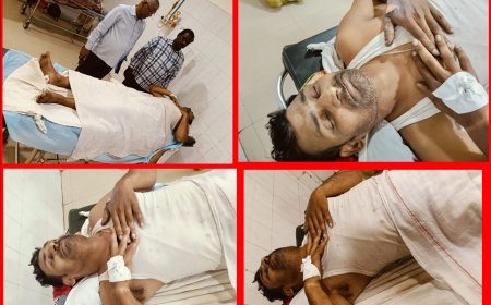 संविदाकर्मी बृजमोहन मिश्रा करेंट की चपेट में आया ट्रामा में भर्ती,विभागीय अधिकारी प्रकरण को दबाने के लिये दे रहे निकालने की धमकी!